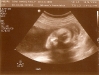 20-week-ultrasound-face-2.jpg
