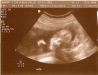 20-week-ultrasound-face.jpg