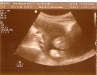 20-week-ultrasound-foot.jpg