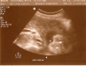 20-week-ultrasound-girl-2.jpg