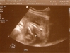 20-week-ultrasound-girl.jpg
