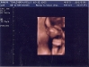 3d-20-week-ultrasound-2.jpg