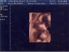 3d-20-week-ultrasound-3.jpg