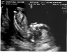 13-week-ultrasound-1.jpg