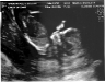 13-week-ultrasound-3.jpg