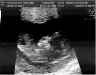 13-week-ultrasound-4.jpg