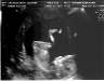 13-week-ultrasound-5.jpg