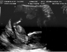13-week-ultrasound-6.jpg