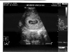 8-week-ultrasound01.jpg