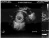 8-week-ultrasound02.jpg